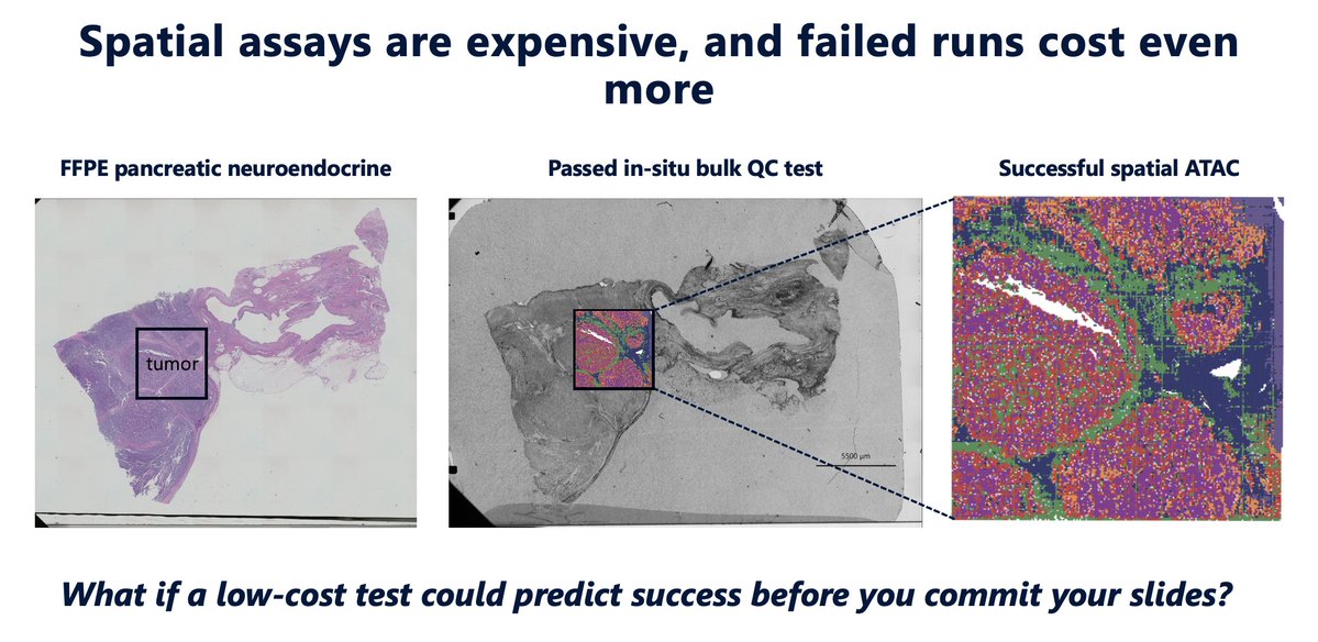 AtlasXomics's tweet image. Case Study Spotlight: Predicting Spatial ATAC-seq Success in FFPE Pancreatic Neuroendocrine Tumor
 
Spatial epigenomic profiling enables high-resolution mapping of enhancer activity and regulatory programs in situ, but FFPE tissue introduces variability in chromatin integrity and…