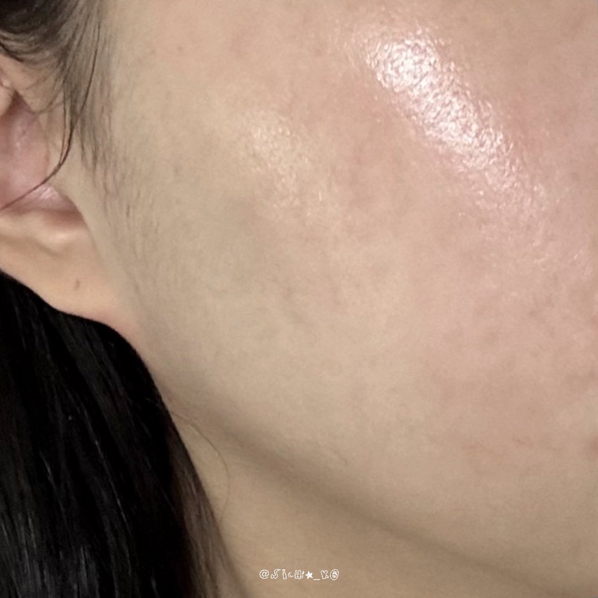 sicha_ko's tweet image. 피부 복구 완.

해달씨 폼클 평생 쓸게요 홍조랑 붉은기 가라앉은 거 보이시죠? 바이럴 아님 돈 받은 거 없음