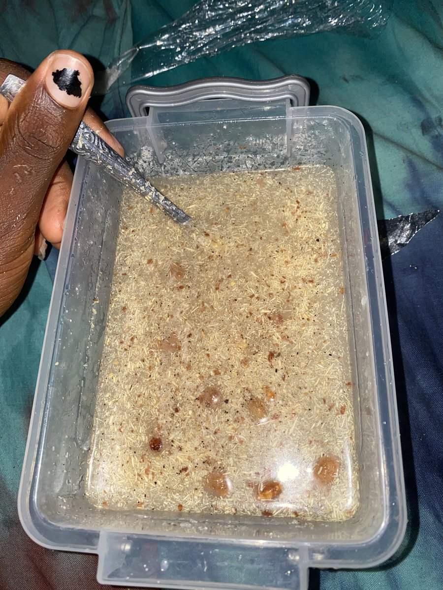 BIG24🏆🥶 tweet media