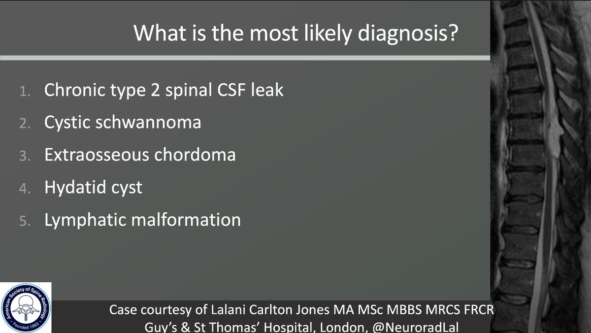 The_ASSR's tweet image. ASSR COTW

History: Progressive spinal pain and Paresthesia

Case c/o Lalani Carlton Jones

#SpineRad #NeuroRad #MedEd #FOAMed #FOAMrad #neuroradiology #radiology