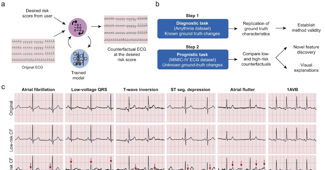 BJAJournals's tweet image. Can #deeplearning analysis of #preoperative #ECGs improve #riskprediction for perioperative major cardiovascular events?

bjanaesthesia.org/article/S0007-…