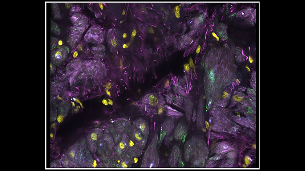 _hubmap's tweet image. Seeking something to make your heart skip a beat? Fishing for results but can’t seem to find the right place to drop your line? Come see Dr. Long Cai &amp;amp; his lab @caltech’s seqFISH image, which shows where in the human heart RNA transcripts reside! It’s absolute heart-istry!