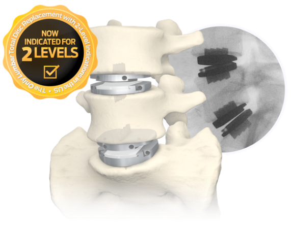 CentinelSpine's tweet photo. Insurance coverage for lumbar #TotalDiscReplacement continues to expand in Arizona, adding 1M more covered lives.

U.S. insurance coverage for @CentinelSpine’s #prodisc® L reaches nearly 95% for 1-level &amp; exceeds 40% for 2-level covered lives.

Learn more: https://t.co/ViLTqG3eqi https://t.co/CIrlgG9HYn