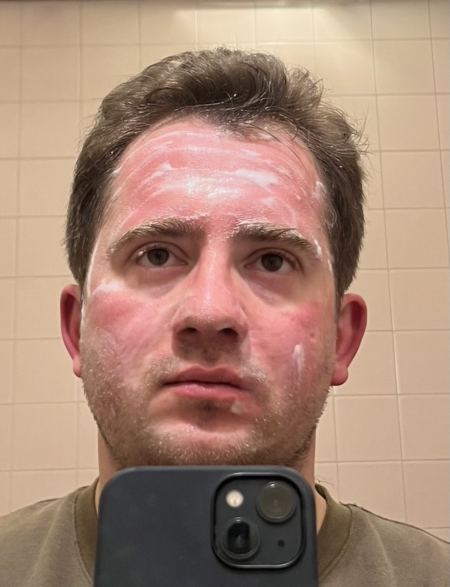 So, the <a href="/BBC/">BBC</a> has now published its investigation. I was among the protesters sprayed by the water cannon laced with a WW1-era chemical that night. This is me afterwards. The symptoms didn’t go away: the burning, the coughing, the shortness of breath stayed with me and so many