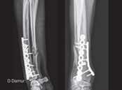 AO Surgery Reference tweet media