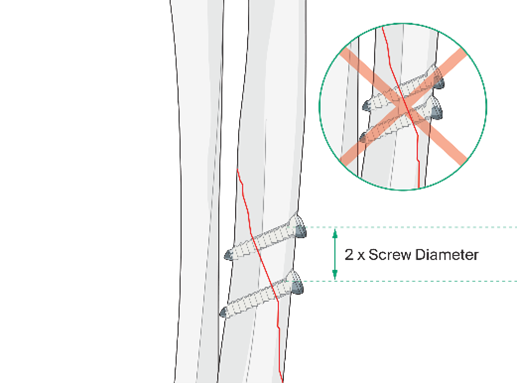 AO Surgery Reference tweet media