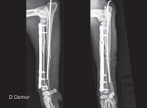 AO Surgery Reference tweet media