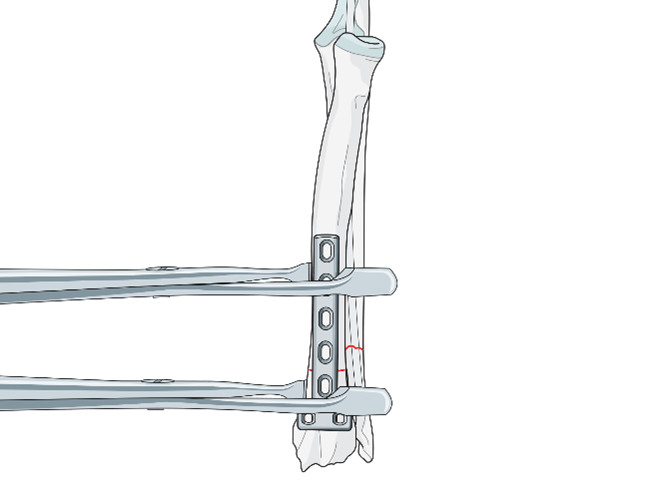 AO Surgery Reference tweet media