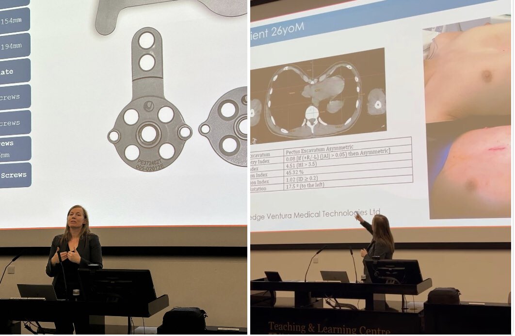 BiomedisysCol's tweet photo. El pasado viernes 28 de noviembre, la Profesora Karen Redmond presentó la técnica Pectus Up® en el Glasgow Pectus Study Day, organizado por la Asociación Británica de Cirujanos Pediátricos en el Queen Elizabeth University Hospital (Glasgow, Reino Unido). https://t.co/sKXnZcQR8e