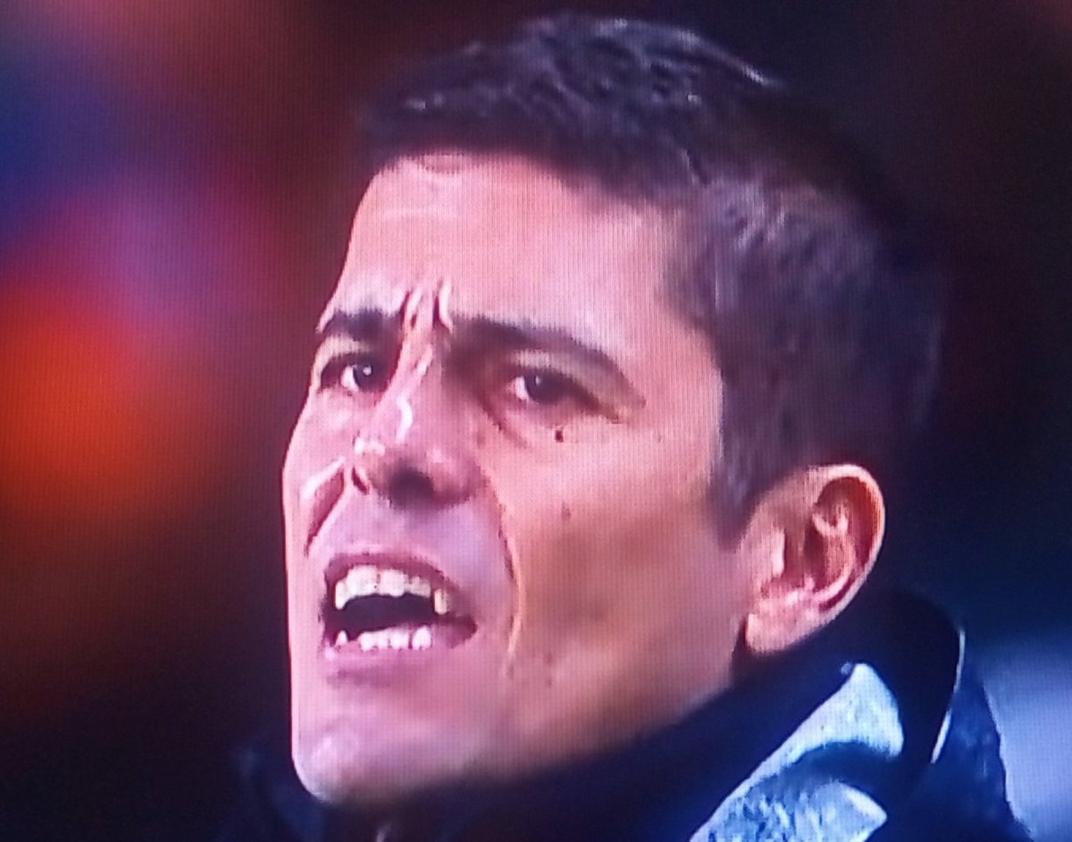 nuncaeofim's tweet image. Meu Deus o treinador de Portugal é um vampiro 😳 amistoso da seleção feminina de futebol #getv