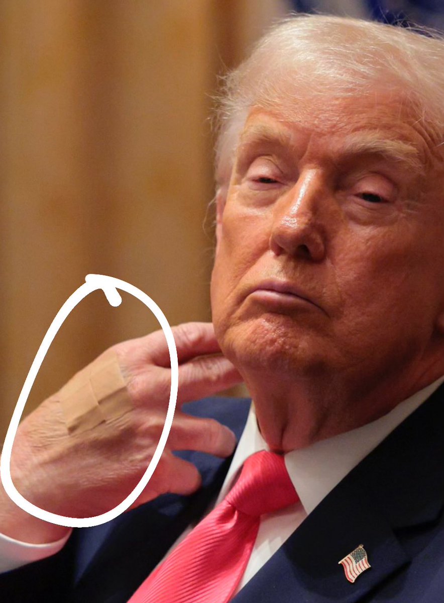 WUTangKids's tweet image. Wtf is going on with his hand now?