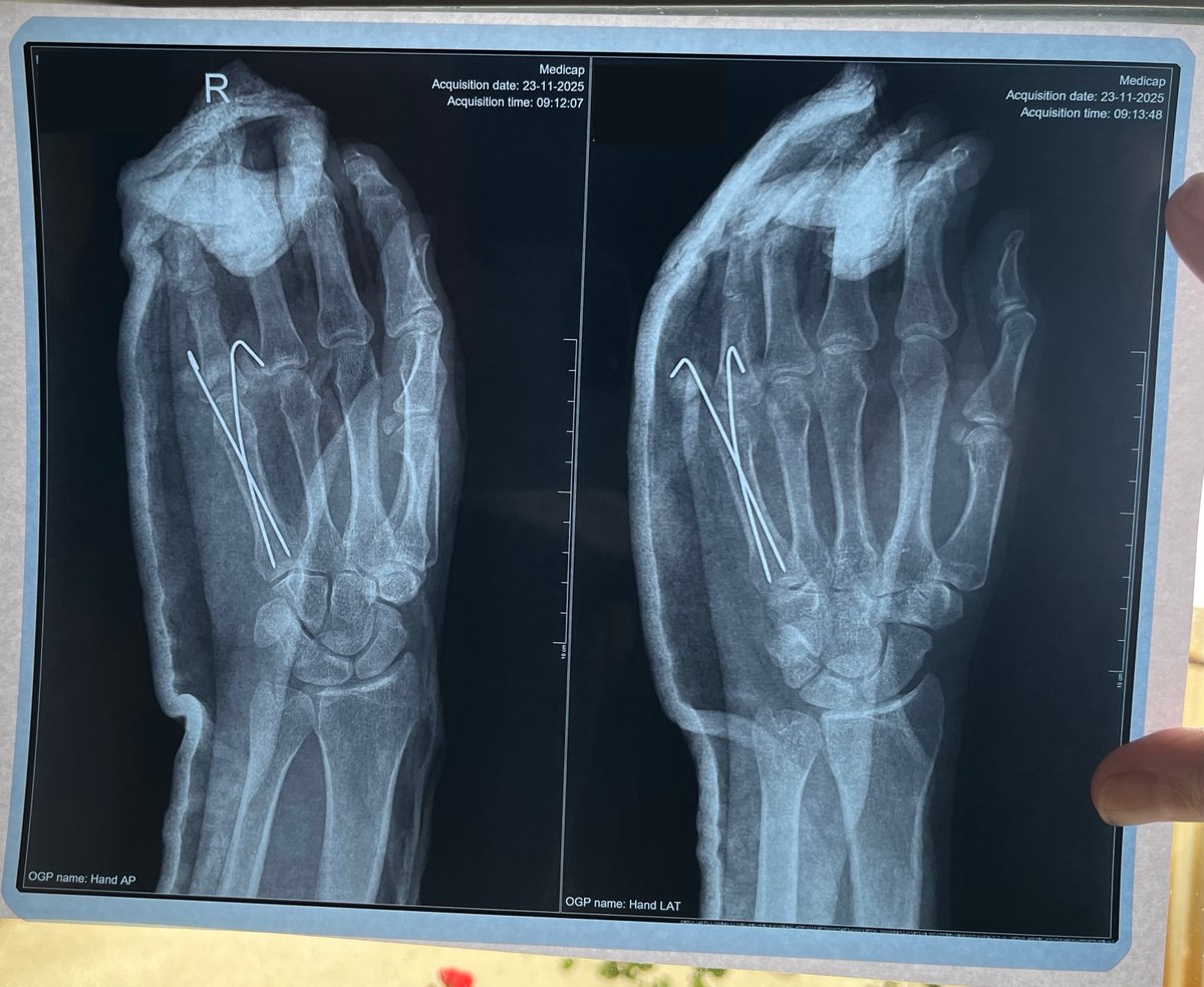 Haven't been here for a while. Has anybody built anything cool in the last month?

I'm currently busy (re)building bone. The DX is bad, but I'm slowly coming back.