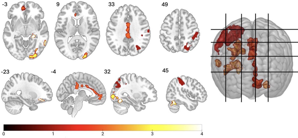 Valentina Lorenzetti (she/her) tweet media