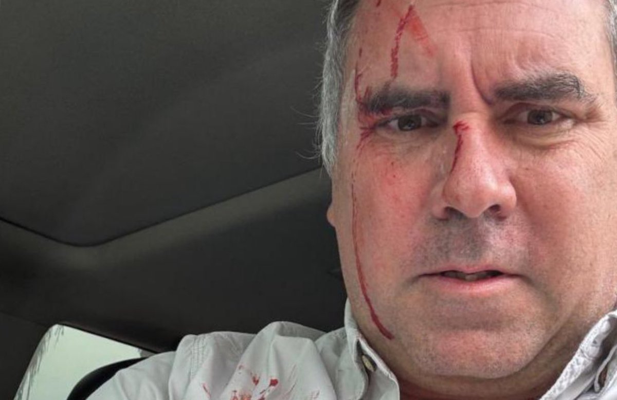 Extrañas coincidencias 

Resulta por lo menos extraño que el candidato Rafael Belaunde llegue a visitar su obra justo el día que le había dado permiso a todo el personal. Ayer lunes el mismo Belaunde llamó a su personal a darle el día libre y justamente llega él y hay un supuesto