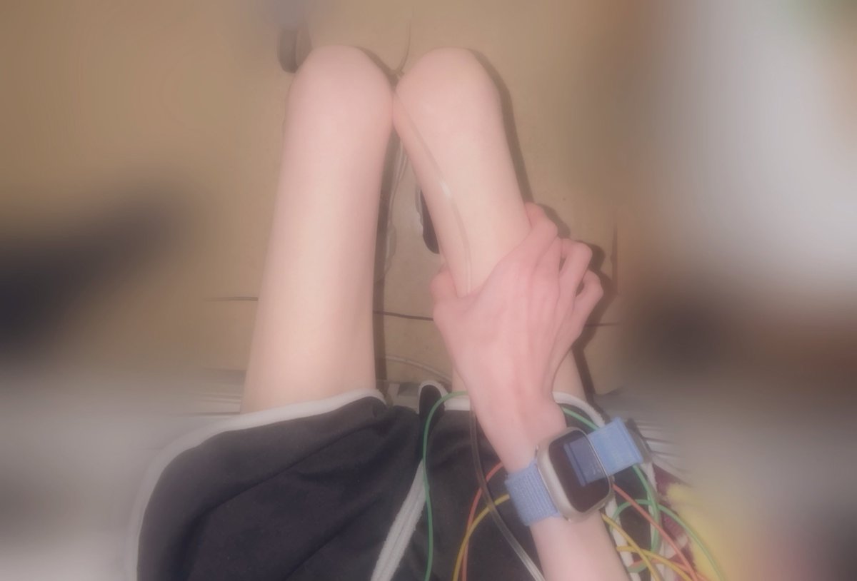 mi_nya_404's tweet image. 朝不安で測ってみたら
太もも22㌢上腕14.5㌢だった😢
測るの辞めたい依存してる囚われてる