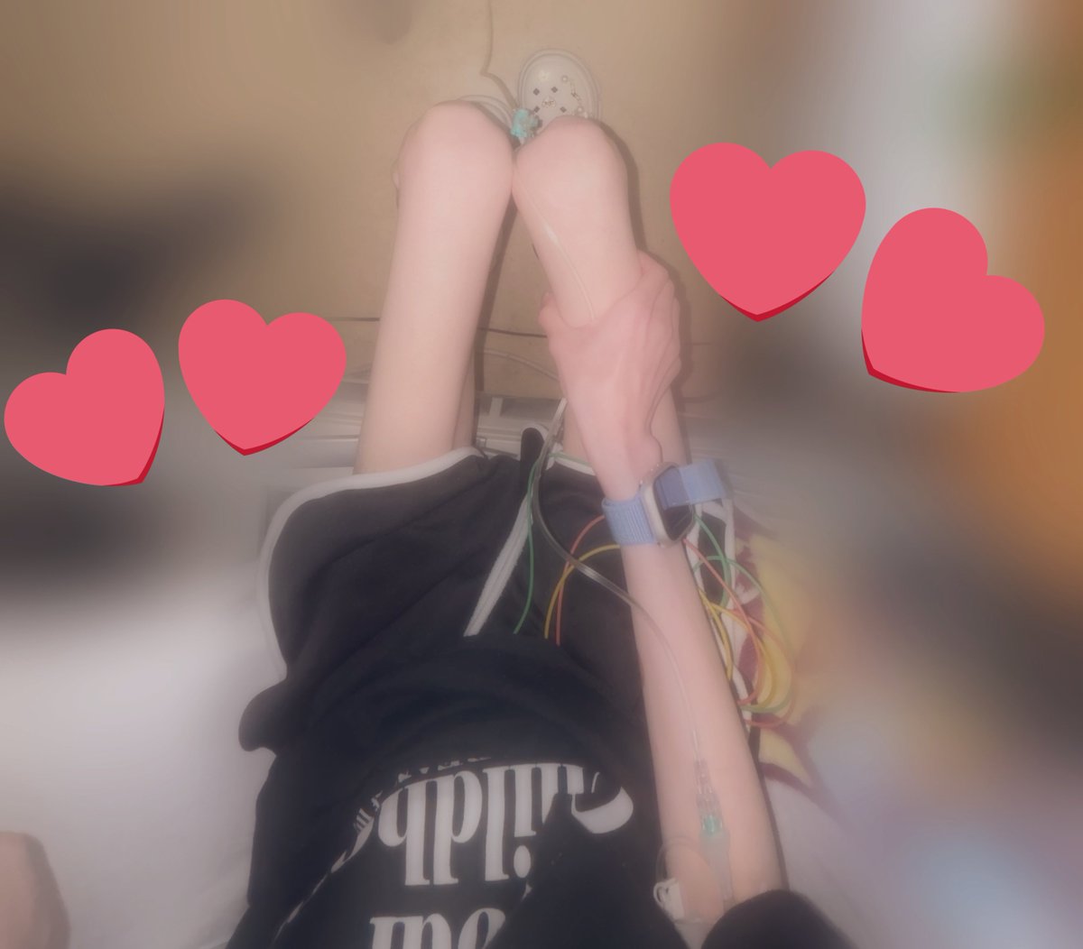 mi_nya_404's tweet image. 朝不安で測ってみたら
太もも22㌢上腕14.5㌢だった😢
測るの辞めたい依存してる囚われてる