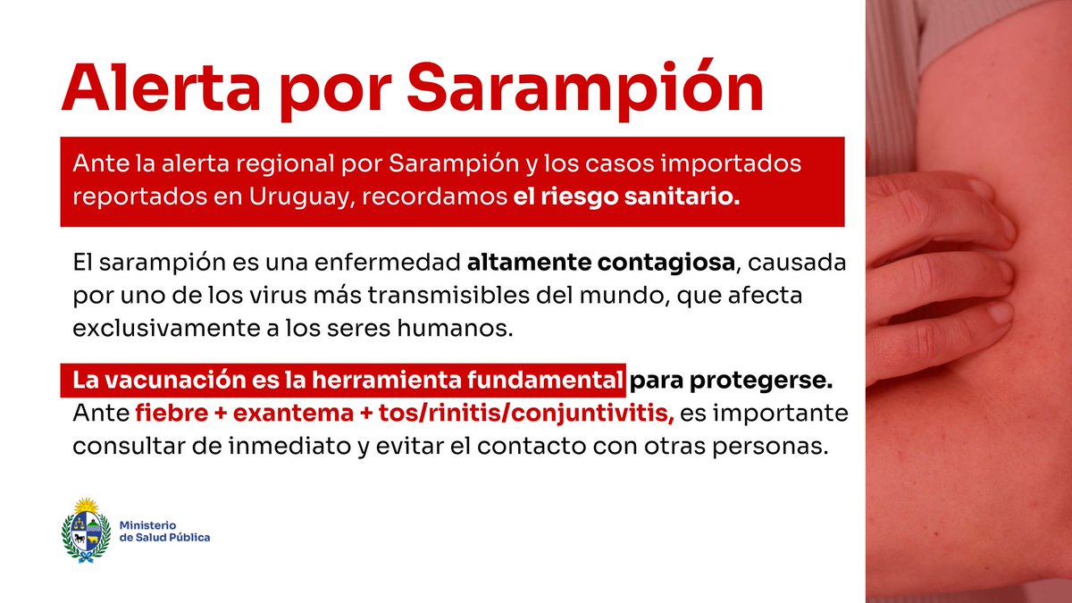 📢 El MSP informa situación epidemiológica del sarampión y campaña de vacunación

➡️ El <a href="/MSPUruguay/">Ministerio de Salud Pública – Uruguay</a> reforzó las acciones de vigilancia y lanzó una campaña para actualizar los esquemas de vacunación en todo el país.
👇👇
smu.org.uy/el-msp-informa…