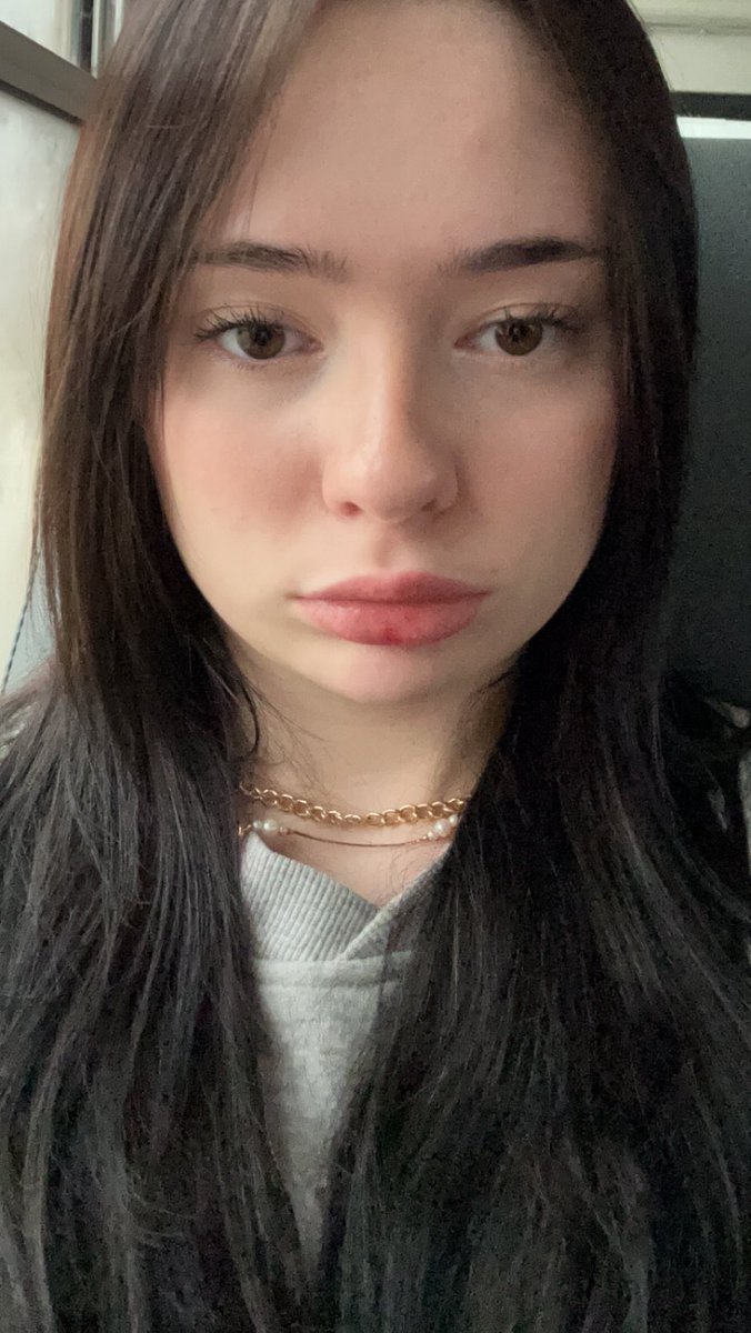 235cals's tweet image. The fat loss in my face is what keeps me from recovering tbh.