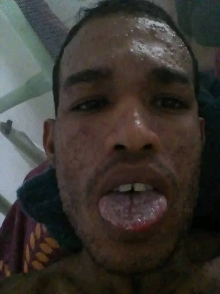 DoctorPatria's tweet image. 🚨 DENUNCIA URGENTE — PRISIÓN VEGUITA 1, YARA, GRANMA 🚨

El recluso Daniel David García Hernández está en estado crítico y la dictadura lo está dejando morir sin atención médica.

Lleva una semana con:
 • Fiebres de 40°C
 • Orinando sangre
 • Llagas en todo el cuerpo y en la…