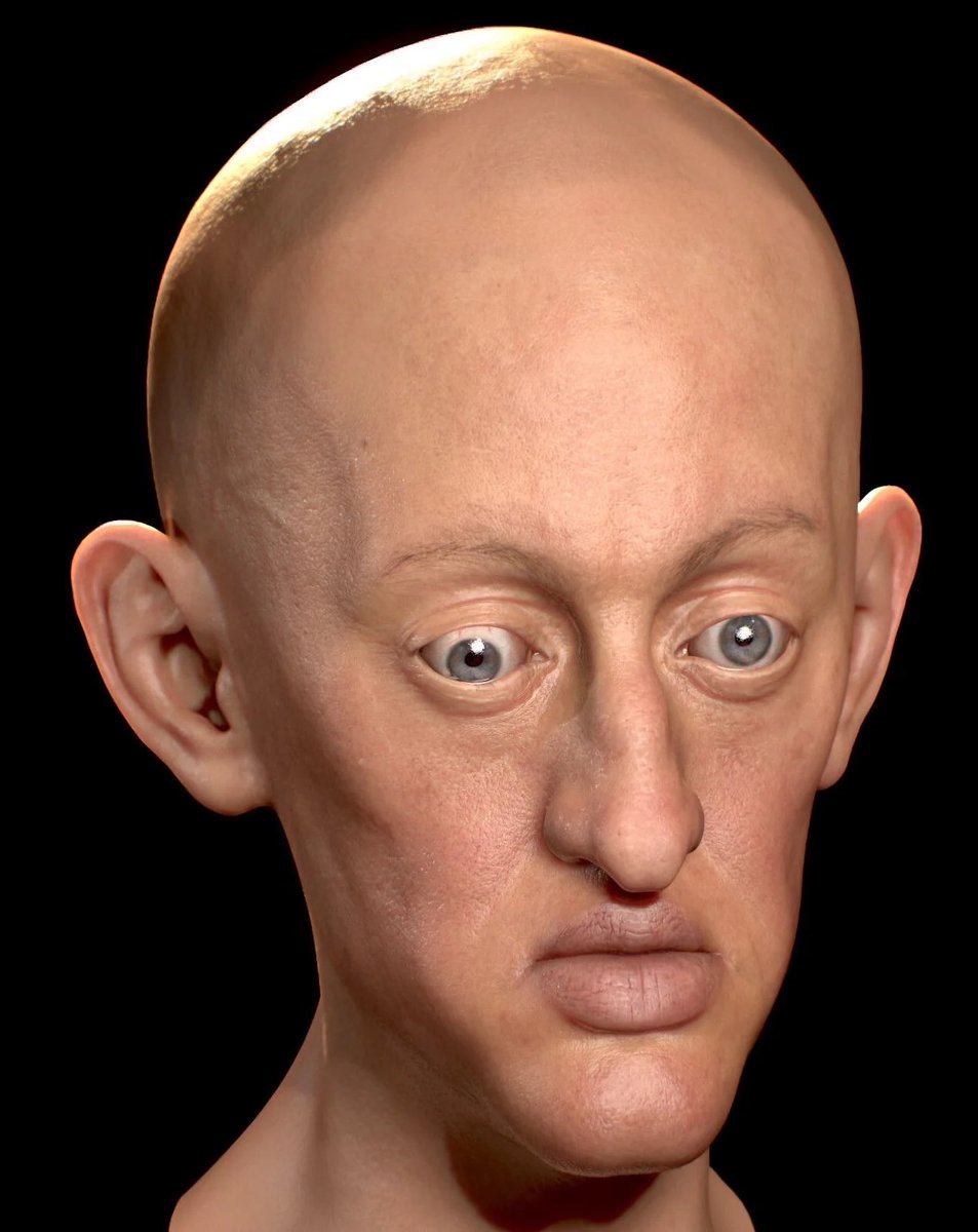 Unexplained's tweet image. Born in 1661, King Charles II of Spain was the result of 200 years of inbreeding that intended to STRENGTHEN the family line. 

He was breastfed until the age of 4 and never fully learned how to walk. Before reaching the age of 6, Charles miraculously survived a series of…