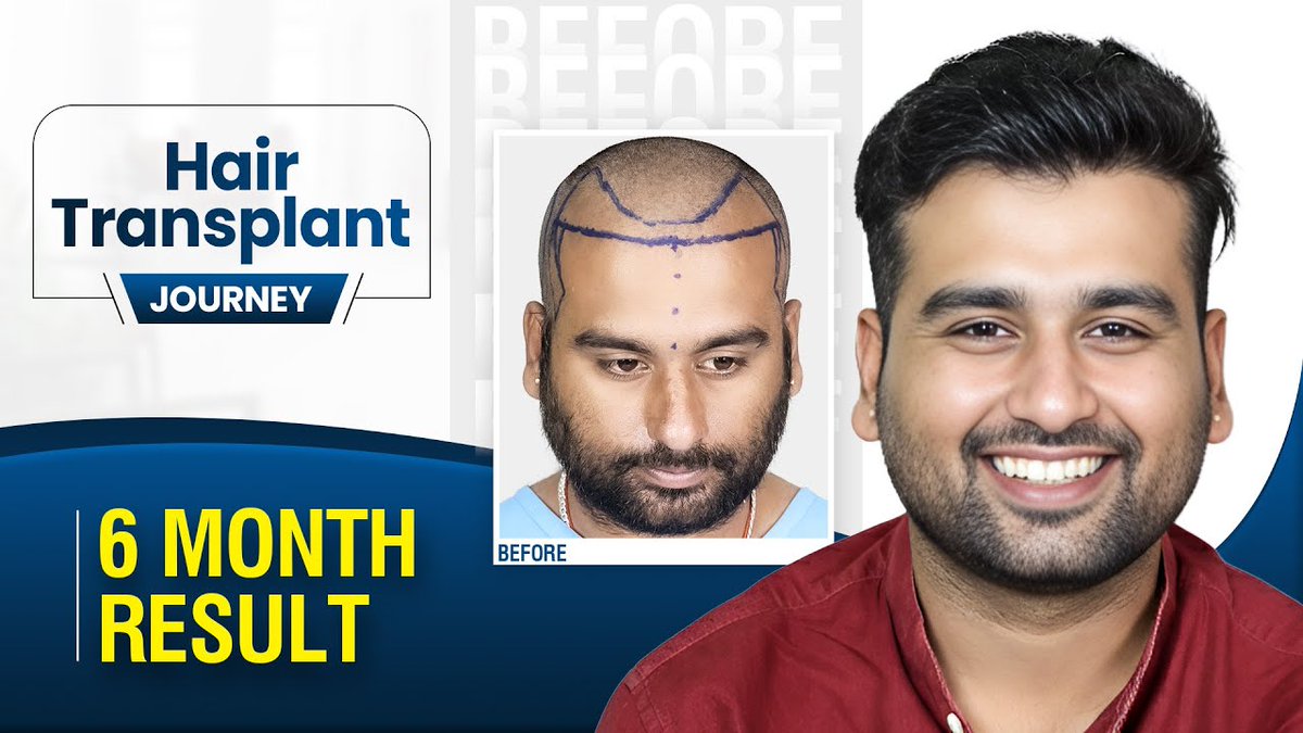 Hairfree and Hairgrow - Hair Transplant Clinic tweet media