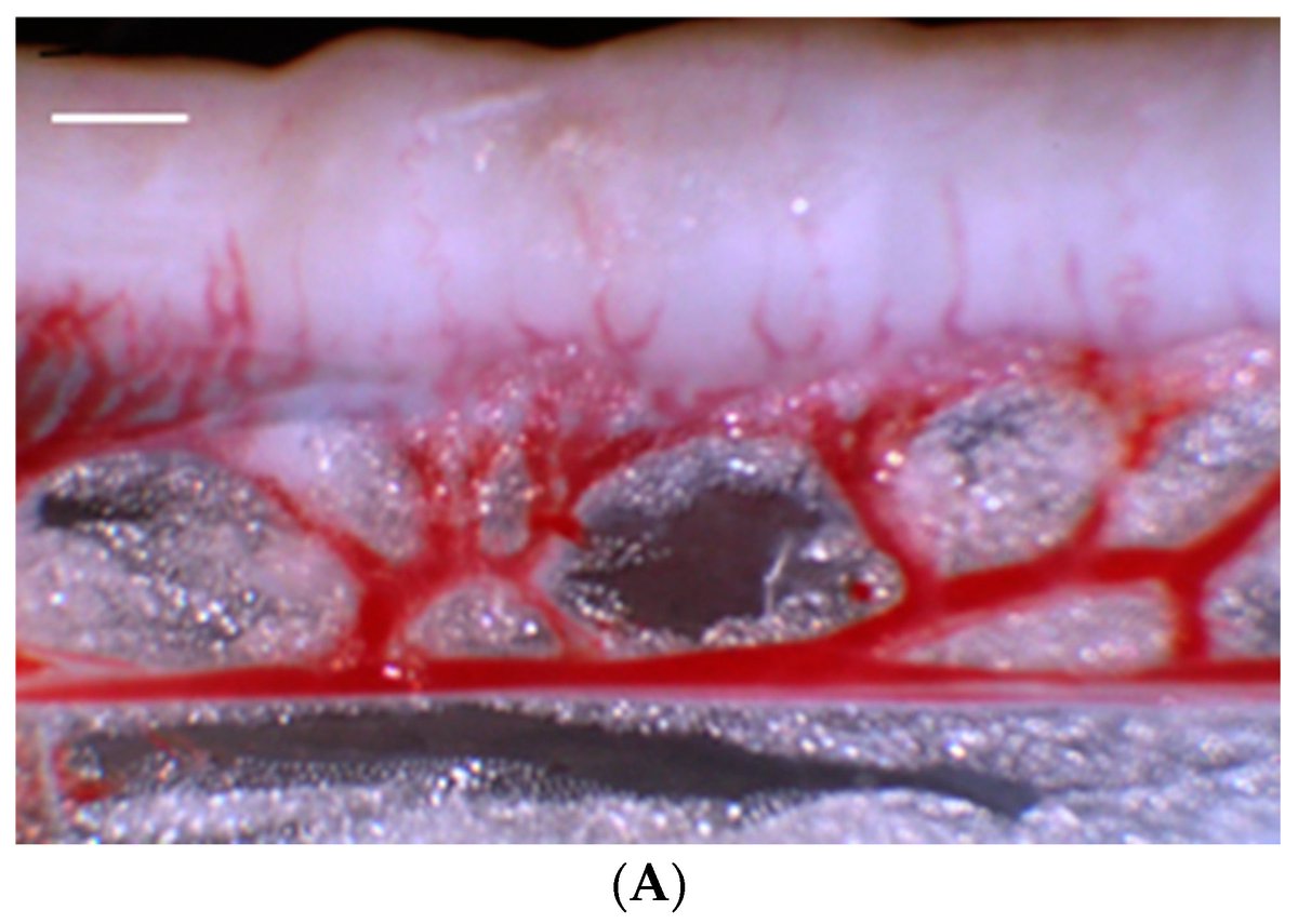 Targets_MDPI's tweet image. #callforreading #mdpi #article #OpenAccess @MediPharma_MDPI  

🎯Interesting research article by @Targets_MDPI !

🧬&quot;Uterine Myometrial Distension Augments the Production of Angiogenic and Proinflammatory Factors&quot;
👉mdpi.com/2813-3137/3/1/3
#immunology #vascularremodeling