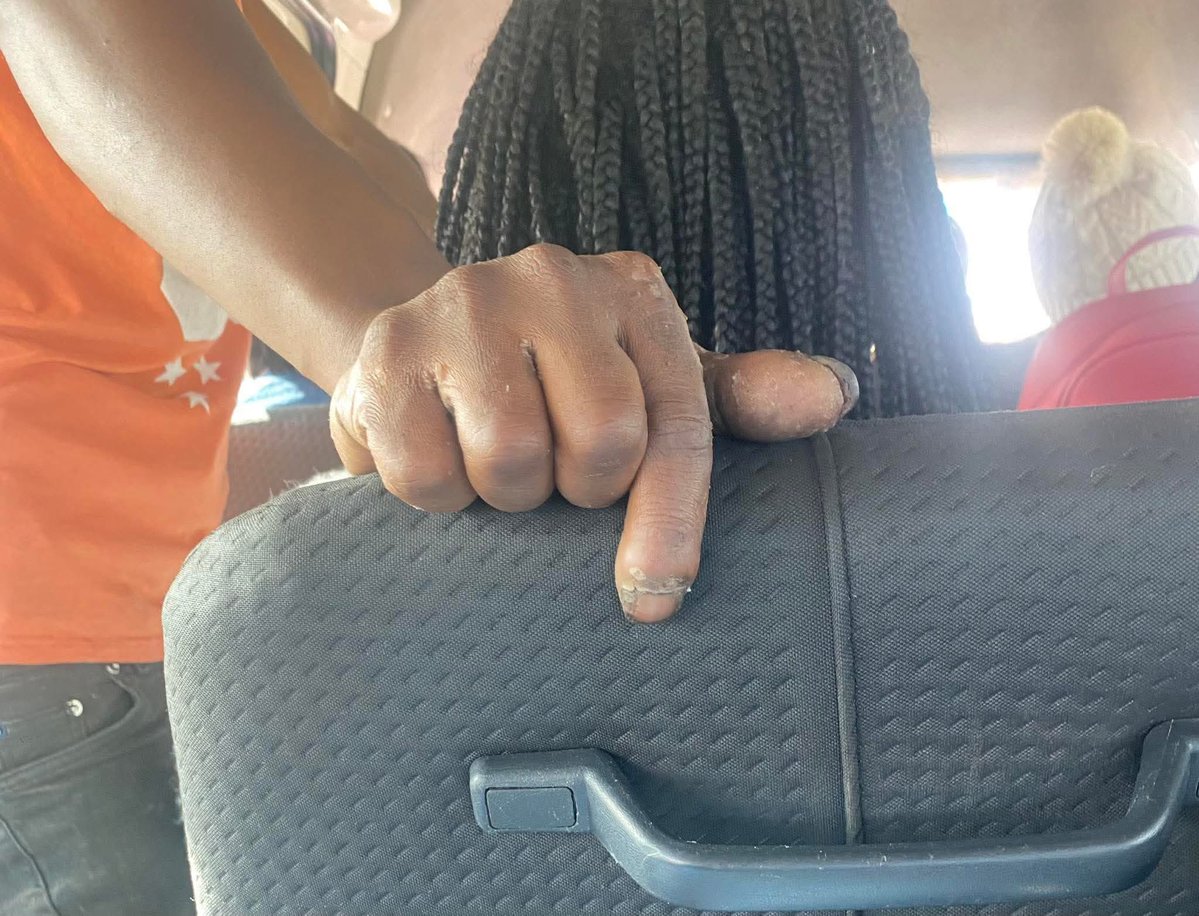 The reason behind that yeast infection ladies😭😭😭😭😩