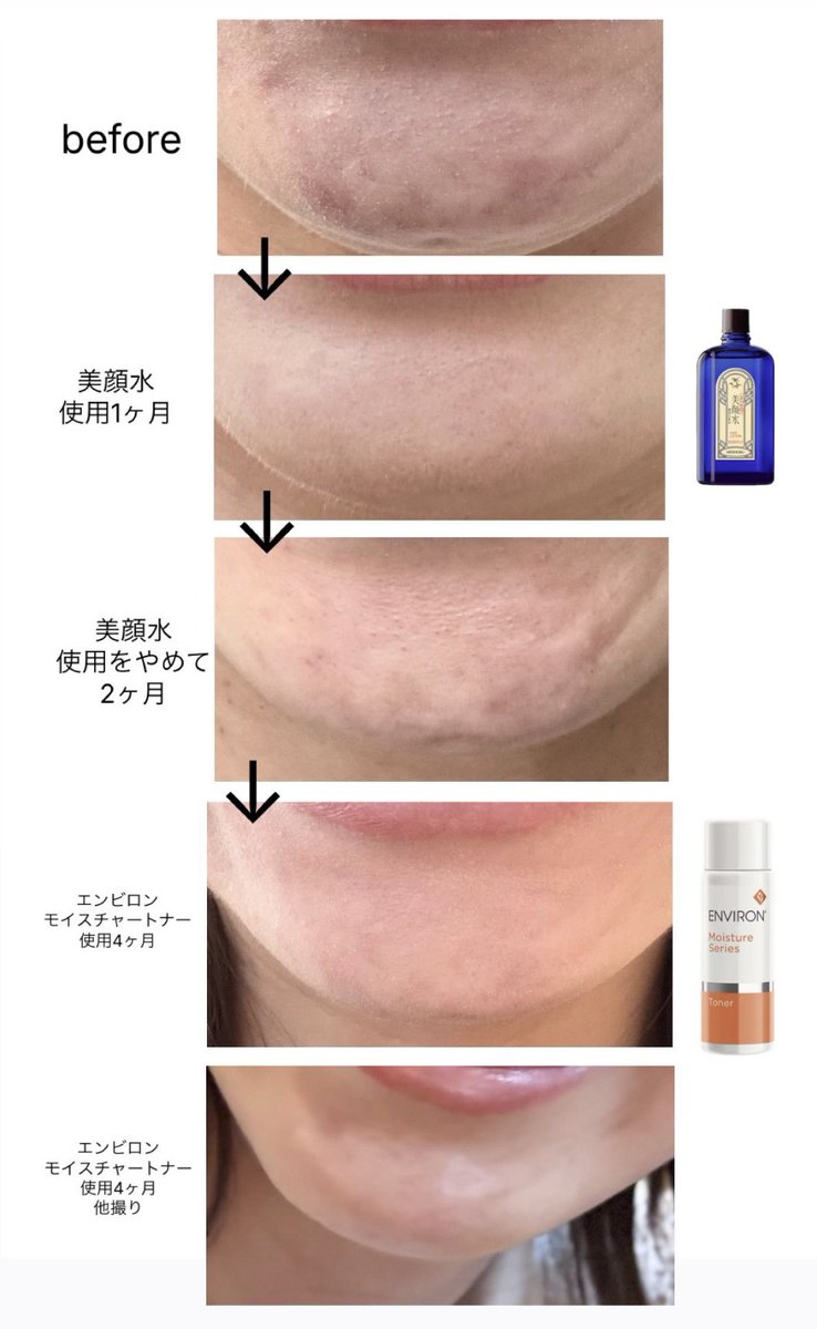 明色美顔水【公式】 (@bigan_official) / Highlights / X