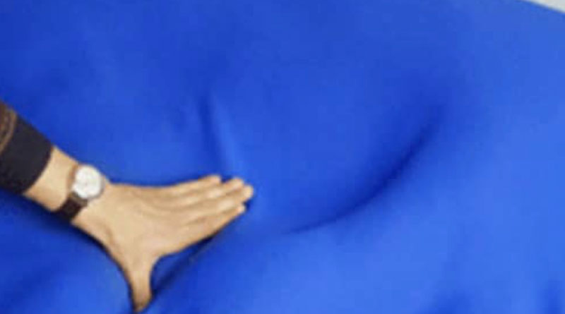 Grand(E) Way To Address Scoliosis Support thecareruk.com/grande-way-to-… #Business_News #Care_Homes #Medical_Aids