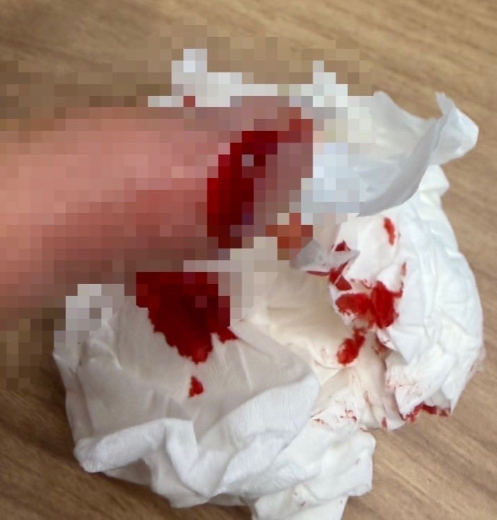 Masa🐳 tweet media