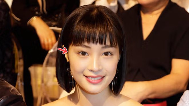 sonsbnb's tweet image. ずっと疑問なんだけど

美女特有のこめかみの膨らみの正体ってなんなの？？？

頬骨にしては上すぎるし、
頭蓋骨見てもこのエリアには骨ないし、永遠の謎すぎる