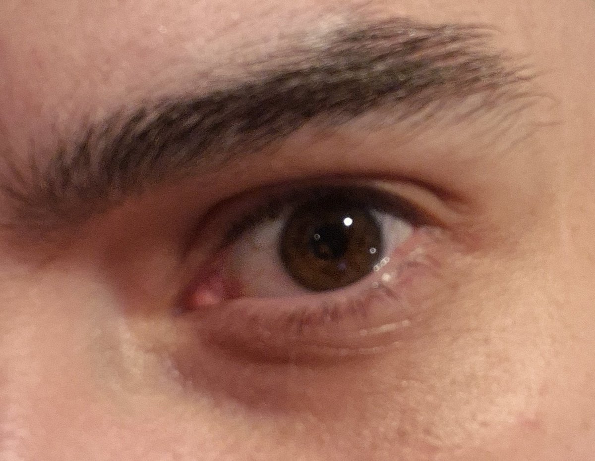 do i have a eye card