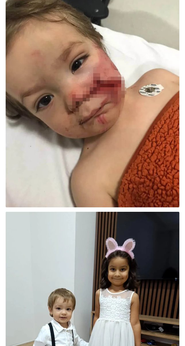 __pErvIN__'s tweet image. Saldırgan ırk beslemek suç! 
Sahipli imiş .. köpeğine sahip olabilse bu gün bu masum ömür boyu bu saldırının izini yüzünde taşımak zorunda kalmazdı! 
Bu çocuklar şanslı sayılır çünkü hayattalar. Ya ölenler!
Bu yaşadıkları travmanın sorumlusu ittaparlardır.

Başıboş köpekler…