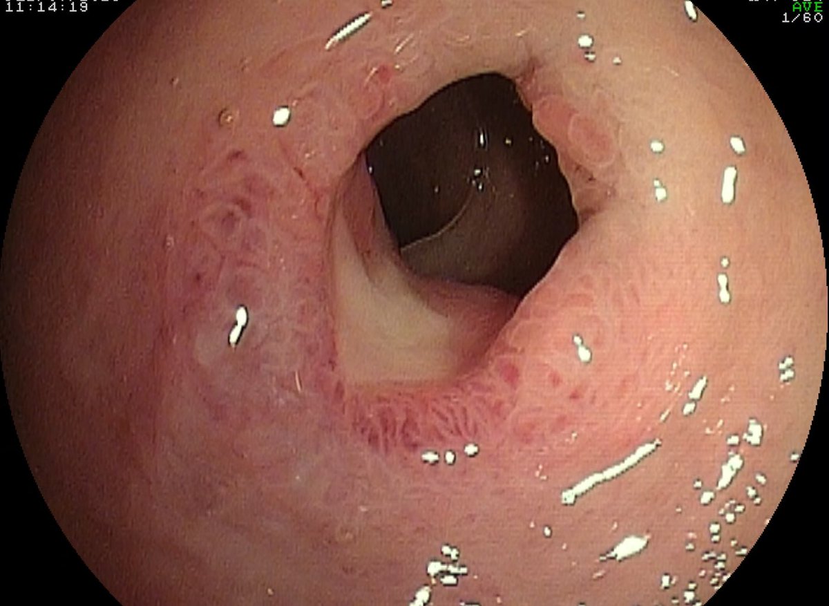 EndoCollab™ | GI Endoscopy Community tweet media