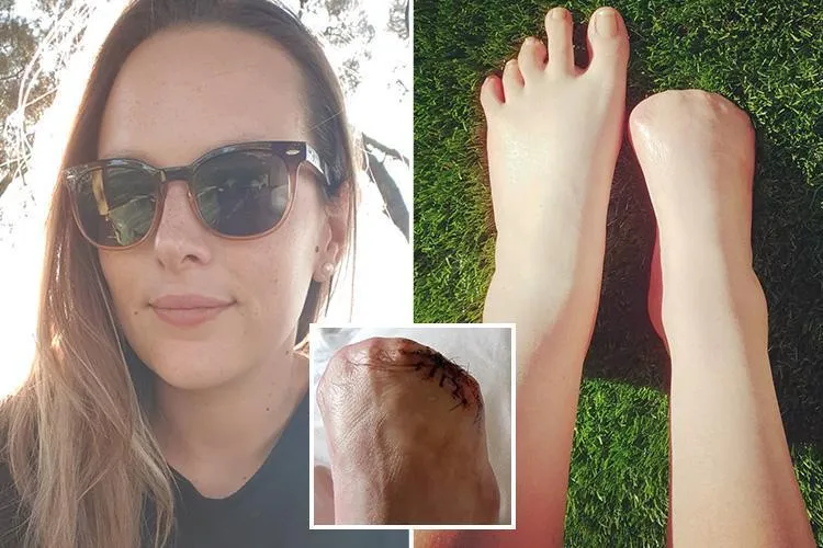 Cultination1's tweet image. 🚨🇦🇺🇹🇭UN PETIT PLAISIR EN VACANCES SE TRANSFORME EN CAUCHEMAR D'UNE VIE : ELLE PERD SES 5 ORTEILS APRÈS UNE PÉDICURE AUX POISSONS EN THAÏLANDE. 

Victoria Curthoys, une Australienne, a contracté une infection grave lors d'une pédicure aux poissons en Thaïlande en 2010.

En 2006,…