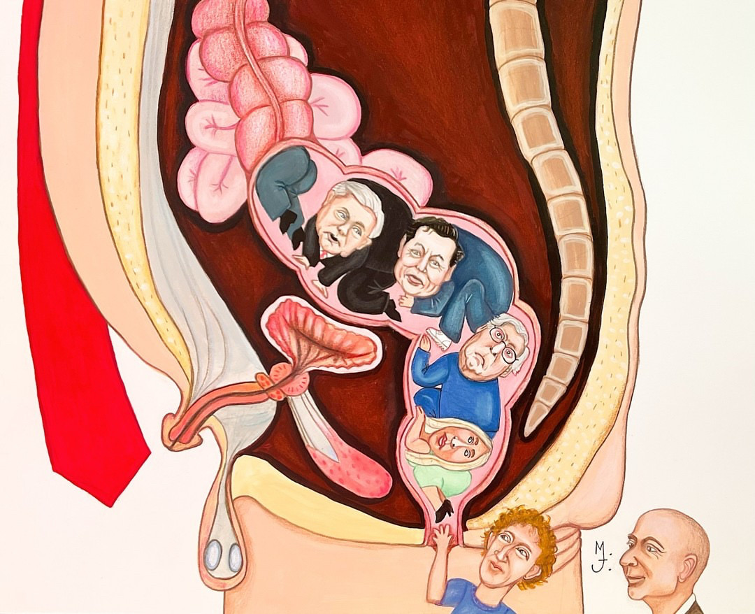 President Epstein's MRI images have leaked out: