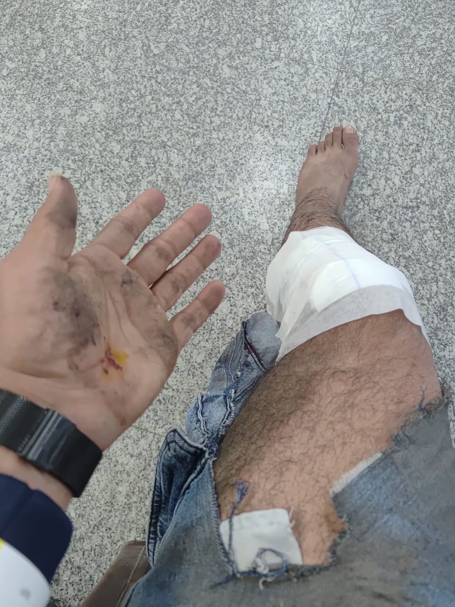 552397's tweet photo. @Uber_India becoz of yr rider i met an accidnt, he was too bad &amp; speedy that bike got slipped I got stitches on my left knee &amp; multiple small wounds, now 1000rs daily medicine is there &amp; I m leave due to injury. @ConsumerSupIn @consumerCOMPLNS @nch1915 no one from uber helped me https://t.co/aFrNw5GCiW