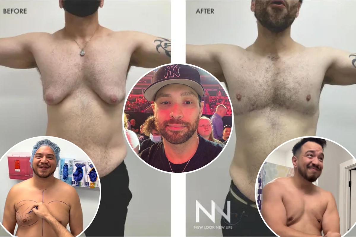 nypost's tweet image. Meet the men getting breast reductions — which is now the most popular plastic surgery among guys in the US trib.al/mMZ1kGA