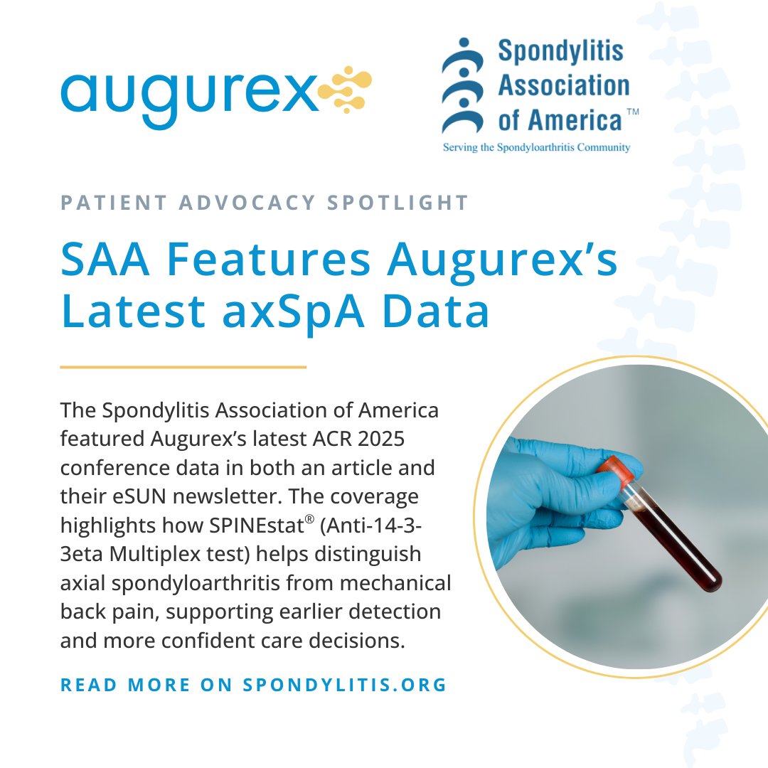 We’re excited to see the <a href="/spondylitis/">Spondylitis.org</a> Association of America feature Augurex’s latest ACR 2025 data in a new article and eSUN newsletter. The coverage highlights how SPINEstat® (Anti-14-3-3eta Multiplex test) may help improve early axSpA diagnosis &amp; care. spondylitis.org/research-new/n…