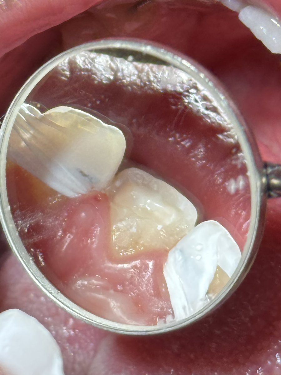 ساعد الغامدي tweet media