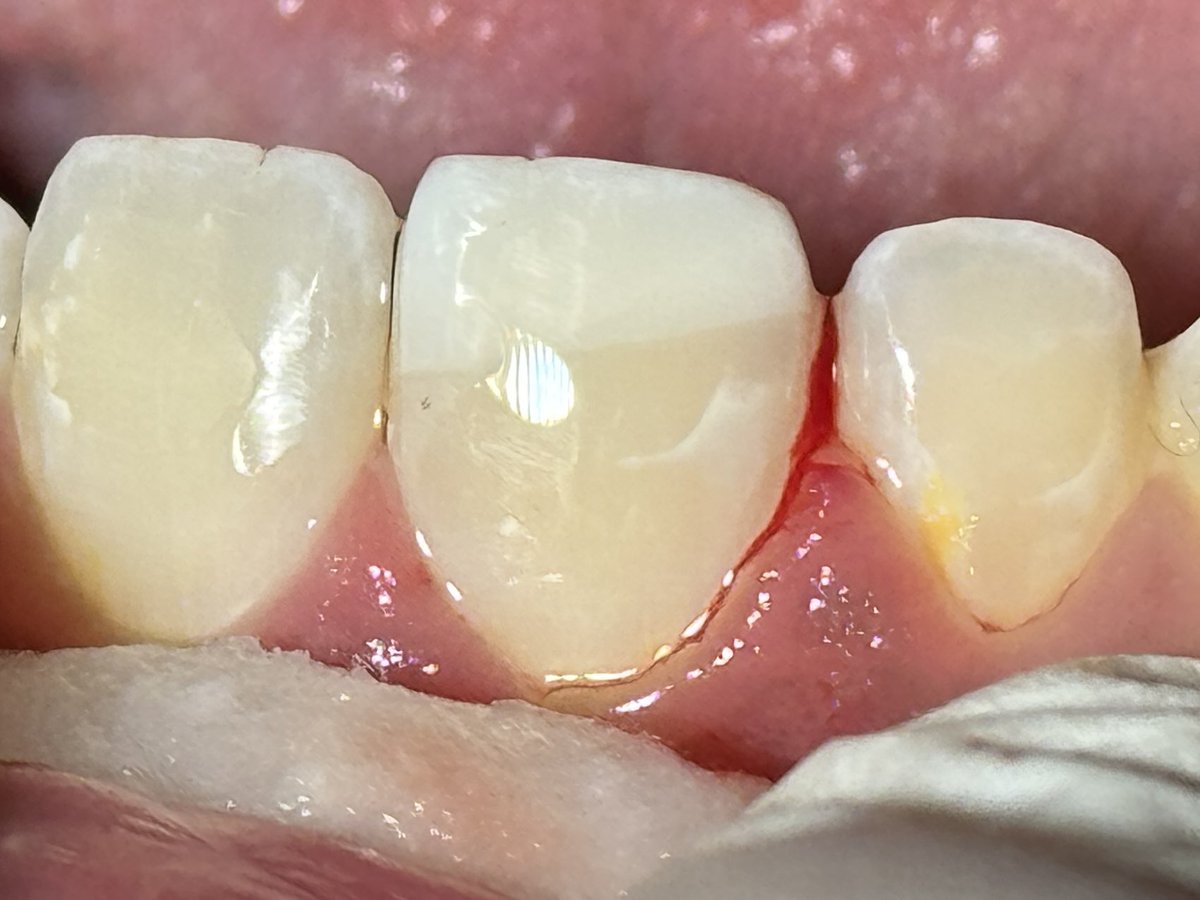 ساعد الغامدي tweet media