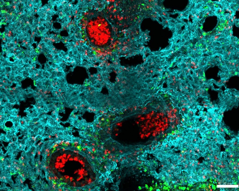 NeuMap, un mapa pionero de neutrófilos que redefine su papel en la salud, las infecciones y la inflamación saludadiario.es/investigacion/… <a href="/CNIC_CARDIO/">CNIC</a>