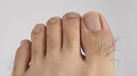 Something to notice.

Good hair growth on the toes usually means good blood flow.

Hair follicles need steady circulation to stay alive. When blood flow is strong, hair stays.