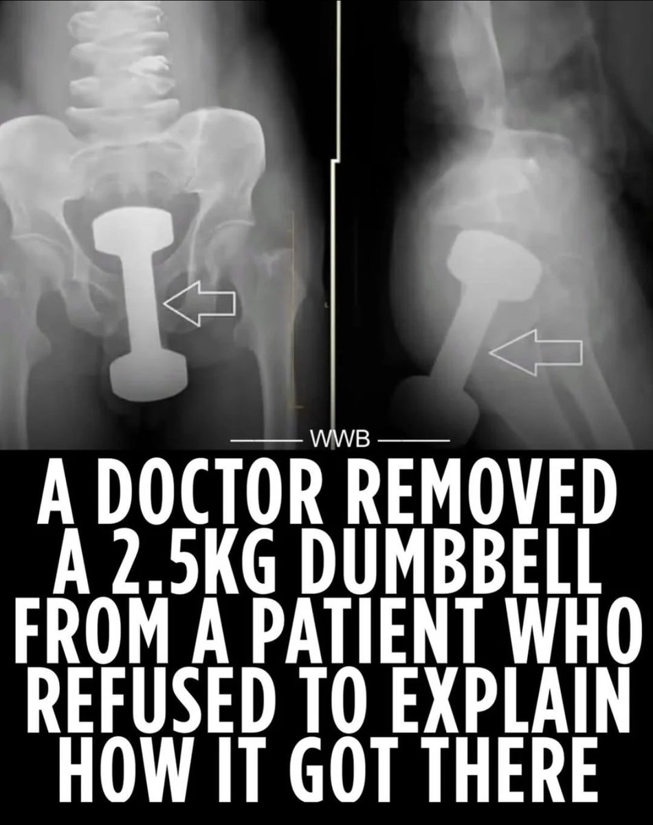 This is how <a href="/TheReaIRobG/">ЯOB.G</a> keeps those sphincter muscles so tight👇