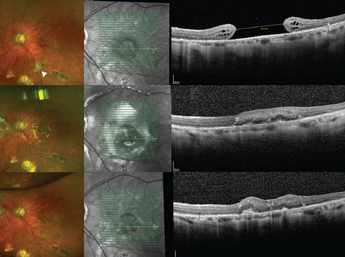 Retina Specialist tweet media