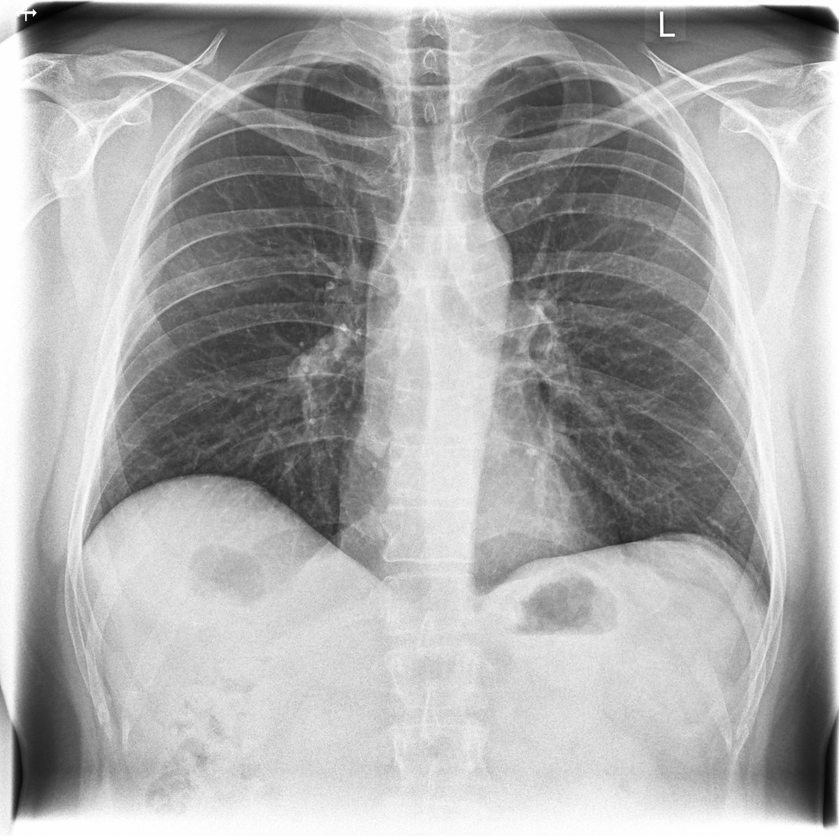 Marco Reps tweet media