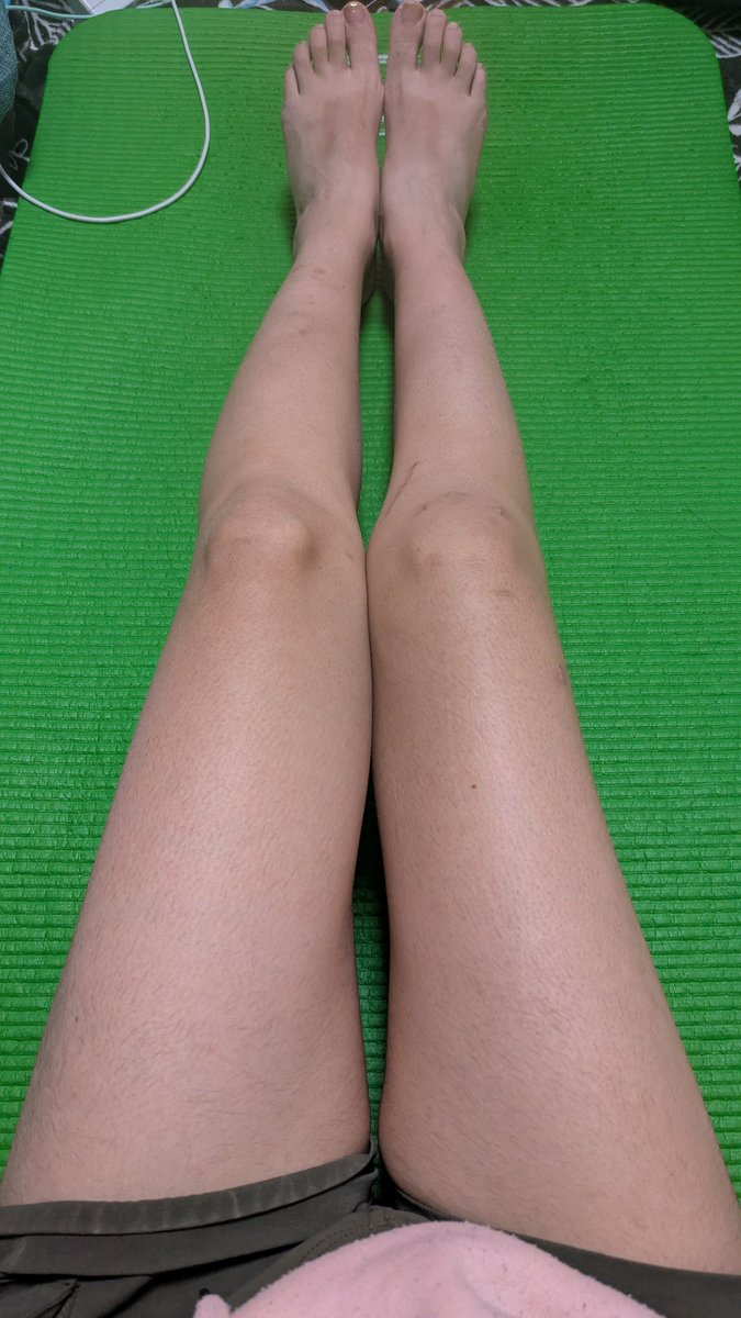右足の筋肉がどんどんどんどん落ちて細くなっている………嘆かわしい………脂肪と皮しかない………