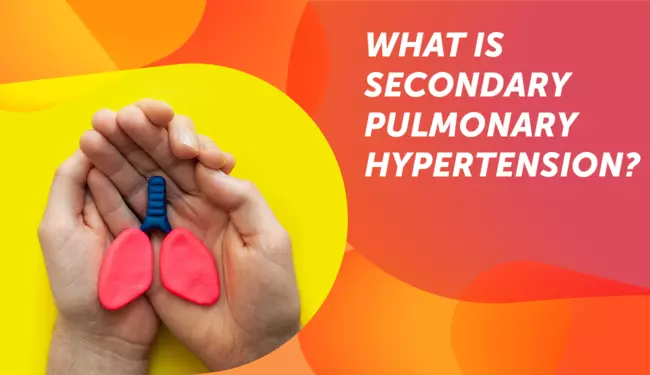 myPHteam's tweet photo. What is secondary pulmonary hypertension (PH) — and what does it mean if you’re diagnosed? Secondary PH happens when high blood pressure in your lungs is caused by another underlying condition, making it harder for blood to flow smoothly. Learn moret: https://t.co/LOhs577qNN https://t.co/CzMkwXYrh1