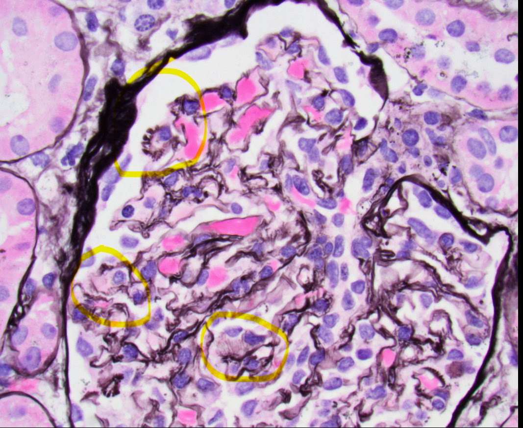 Jonathan Zuckerman MD PhD tweet media