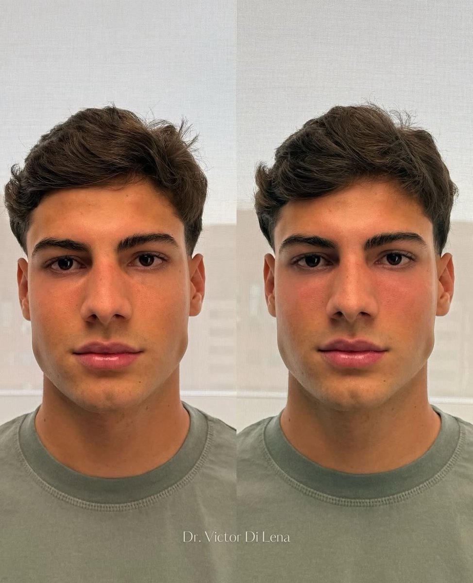 vlucasrocha's tweet photo. e o resultado dessa harmonização facial https://t.co/yfmYmCnY17